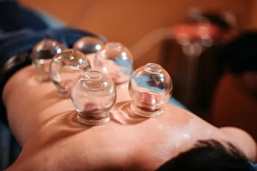 Cupping therapy session at Dukhniwaran Physiotherapy